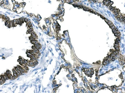 Immunohistochemistry (Formalin/PFA-fixed paraffin-embedded sections) - Anti-pan Cytokeratin antibody [AE1/AE3 + 5D3] (AB86734)