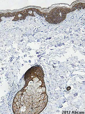 Immunohistochemistry (Formalin/PFA-fixed paraffin-embedded sections) - Anti-pan Cytokeratin antibody [AE1/AE3 + 5D3] (AB86734)