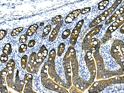 Anti-pan Cytokeratin antibody [AE1/AE3 + 5D3] (ab86734) | Abcam