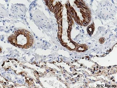 Immunohistochemistry (Formalin/PFA-fixed paraffin-embedded sections) - Anti-pan Cytokeratin antibody [AE1/AE3 + 5D3] (AB86734)