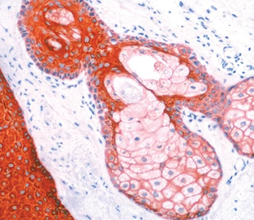 Immunohistochemistry (Formalin/PFA-fixed paraffin-embedded sections) - Anti-pan Cytokeratin antibody [AE1/AE3 + 5D3] (AB86734)