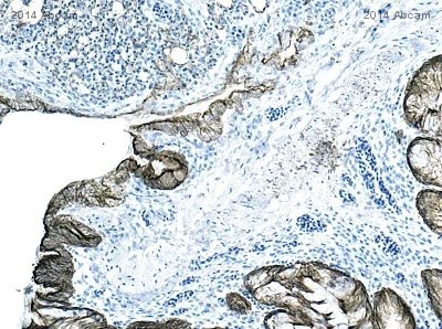 Anti-pan Cytokeratin antibody [AE1/AE3 + 5D3] (ab86734) | Abcam
