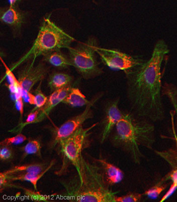 Immunocytochemistry/ Immunofluorescence - Anti-pan Cytokeratin antibody [AE1/AE3] - BSA and Azide free (AB80826), expandable thumbnail