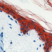 Immunohistochemistry (Formalin/PFA-fixed paraffin-embedded sections) - Anti-pan Cytokeratin antibody [AE1/AE3] - BSA and Azide free (AB80826)