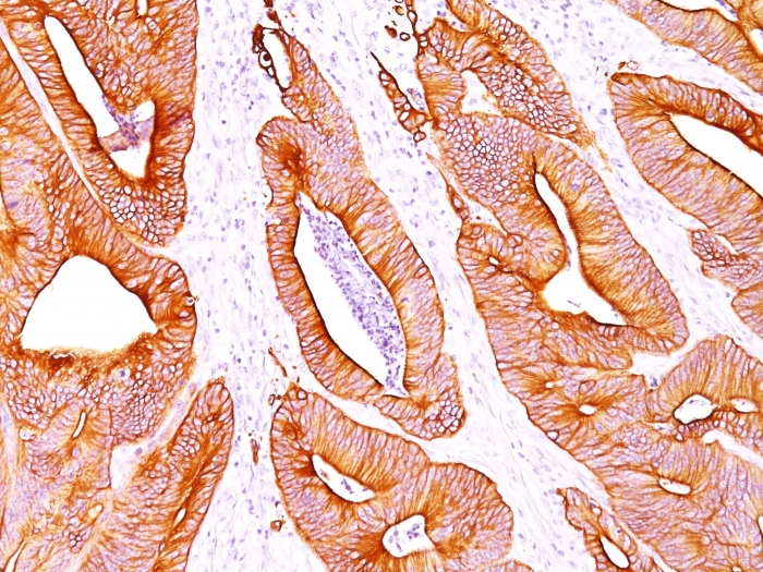Immunohistochemistry (Formalin/PFA-fixed paraffin-embedded sections) - Anti-pan Cytokeratin antibody [AE1/AE3] - BSA and Azide free (AB80826), expandable thumbnail