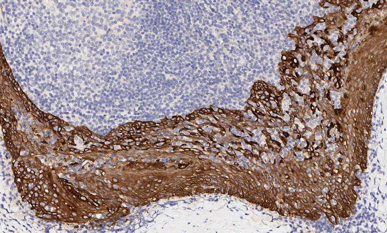 Immunohistochemistry (Formalin/PFA-fixed paraffin-embedded sections) - Anti-pan Cytokeratin antibody [AE1/AE3] - BSA and Azide free (AB80826)