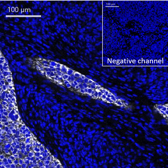 Mass Cytometry - Anti-pan Cytokeratin antibody [AE1/AE3] - BSA and Azide free (AB80826), expandable thumbnail