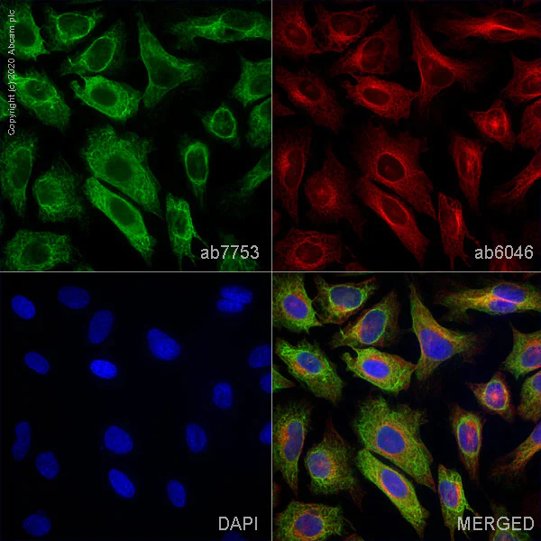 Immunocytochemistry/ Immunofluorescence - Anti-pan Cytokeratin antibody [C-11] (AB7753)