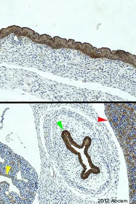 Immunohistochemistry (Formalin/PFA-fixed paraffin-embedded sections) - Anti-pan Cytokeratin antibody [C-11] (AB7753)