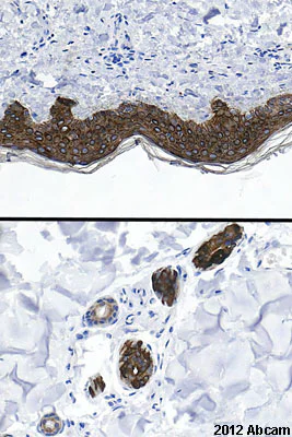 Immunohistochemistry (Formalin/PFA-fixed paraffin-embedded sections) - Anti-pan Cytokeratin antibody [C-11] (AB7753)
