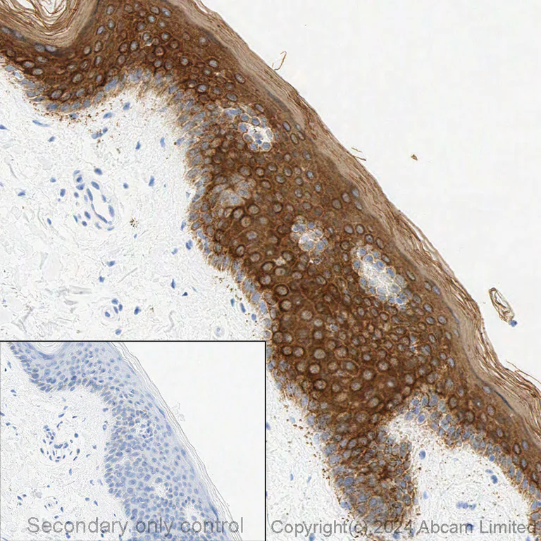 Immunohistochemistry (Formalin/PFA-fixed paraffin-embedded sections) - Anti-pan Cytokeratin antibody [C-11] (AB7753)