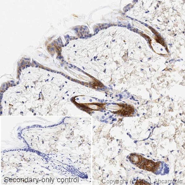Immunohistochemistry (Formalin/PFA-fixed paraffin-embedded sections) - Anti-pan Cytokeratin antibody [C-11] (AB7753)