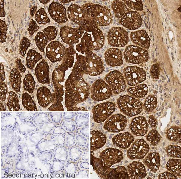 Immunohistochemistry (Frozen sections) - Anti-pan Cytokeratin antibody [C-11] (AB7753)