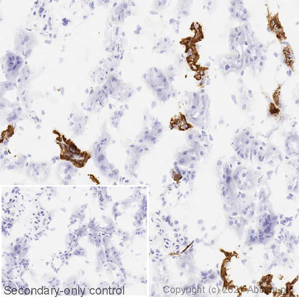 Immunohistochemistry (Frozen sections) - Anti-pan Cytokeratin antibody [C-11] (AB7753)