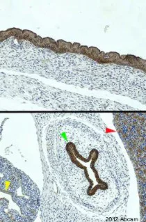 Immunohistochemistry (Formalin/PFA-fixed paraffin-embedded sections) - Anti-pan Cytokeratin antibody [C-11] - BSA and Azide free (AB264485)