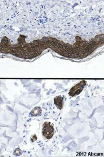 Immunohistochemistry (Formalin/PFA-fixed paraffin-embedded sections) - Anti-pan Cytokeratin antibody [C-11] - BSA and Azide free (AB264485)