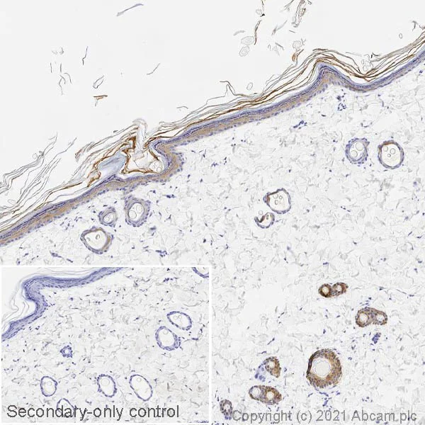 Immunohistochemistry (Formalin/PFA-fixed paraffin-embedded sections) - Anti-pan Cytokeratin antibody [C-11] - BSA and Azide free (AB264485)