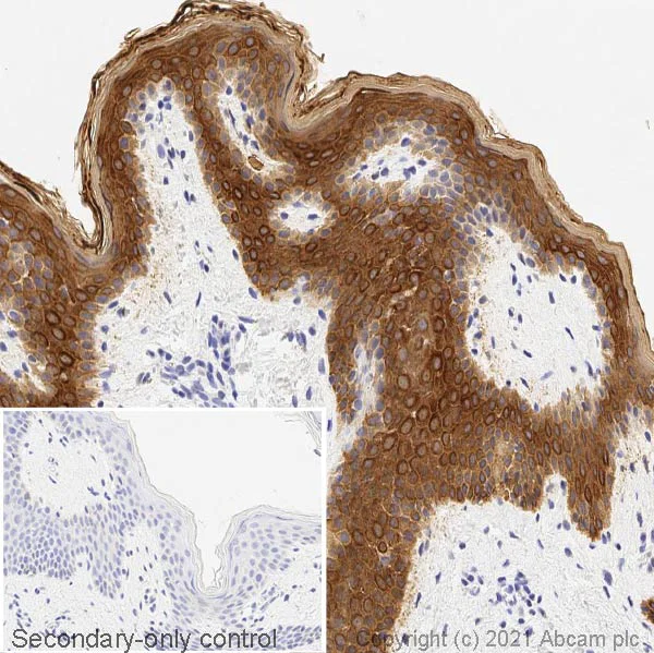 Immunohistochemistry (Formalin/PFA-fixed paraffin-embedded sections) - Anti-pan Cytokeratin antibody [C-11] - BSA and Azide free (AB264485)