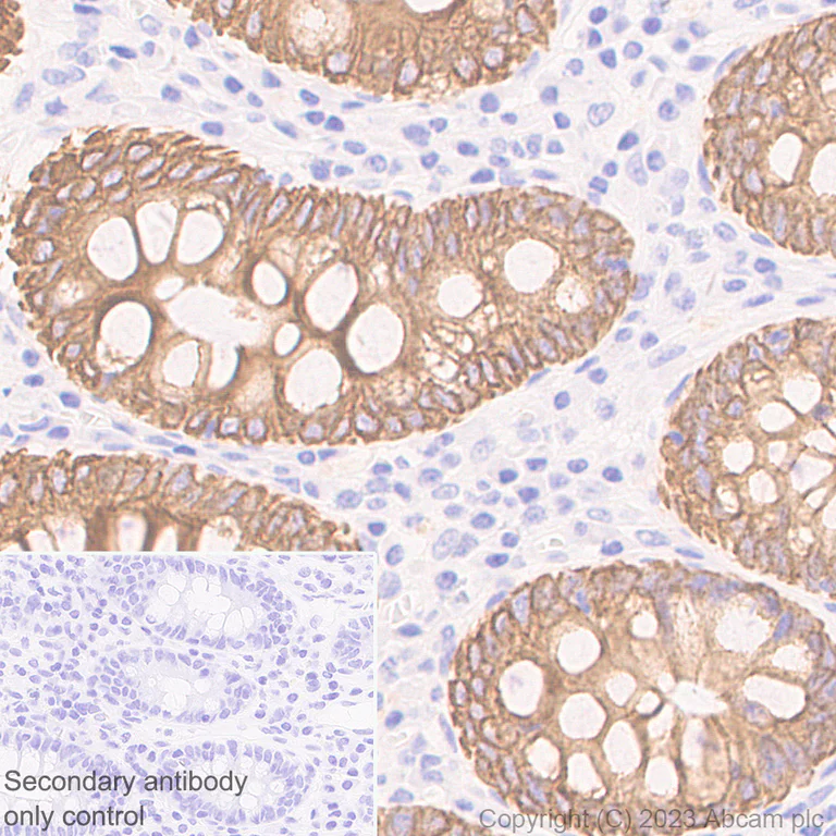 Immunohistochemistry (Formalin/PFA-fixed paraffin-embedded sections) - Anti-pan cytokeratin antibody [EPR28285-45] (AB308262)