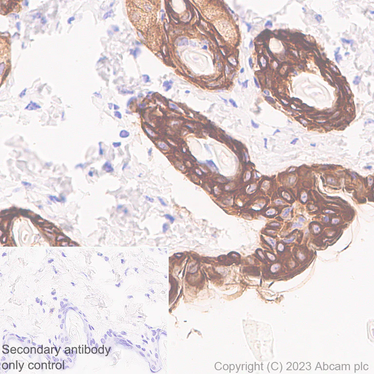 Immunohistochemistry (Formalin/PFA-fixed paraffin-embedded sections) - Anti-pan cytokeratin antibody [EPR28285-45] (AB308262)
