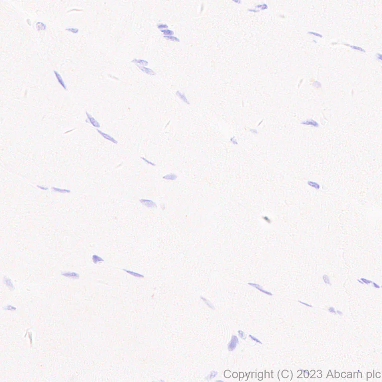 Immunohistochemistry (Formalin/PFA-fixed paraffin-embedded sections) - Anti-pan cytokeratin antibody [EPR28285-45] (AB308262)