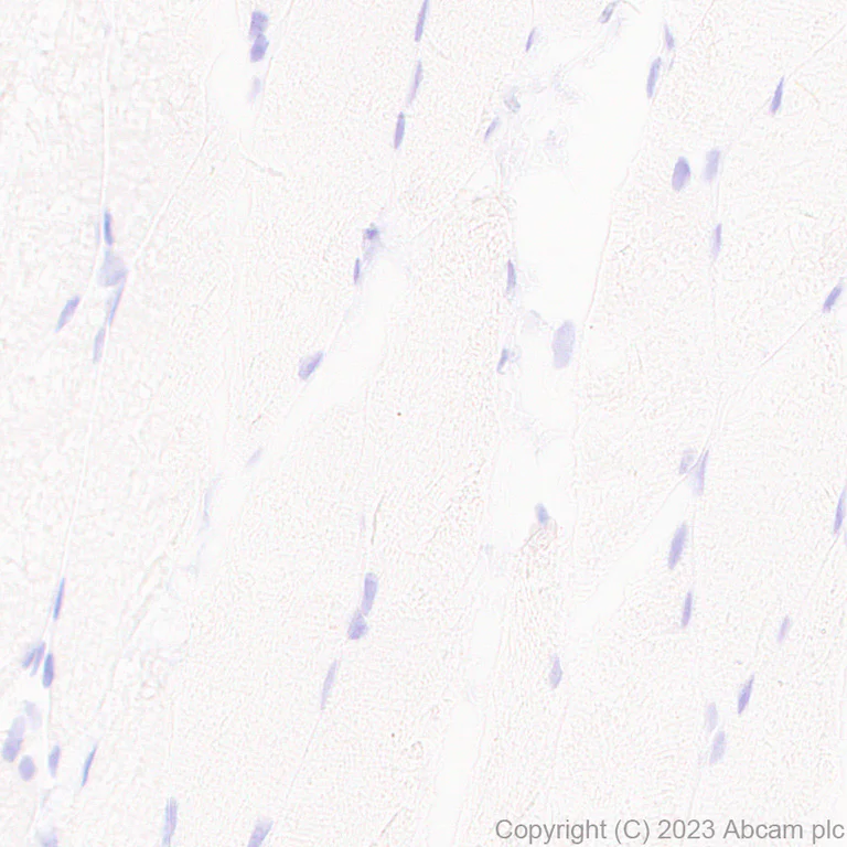 Immunohistochemistry (Formalin/PFA-fixed paraffin-embedded sections) - Anti-pan cytokeratin antibody [EPR28285-45] (AB308262)
