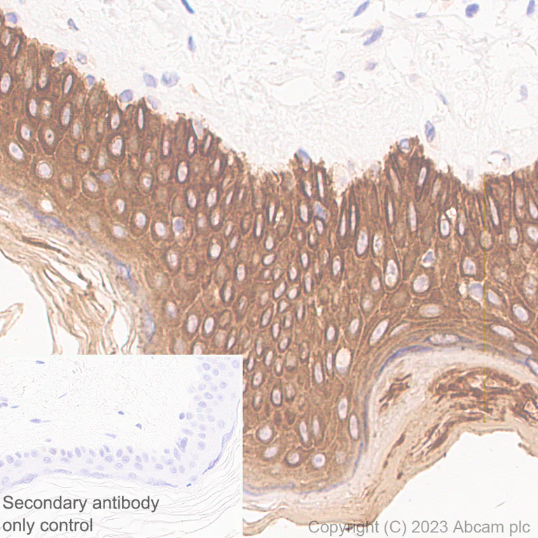 Immunohistochemistry (Formalin/PFA-fixed paraffin-embedded sections) - Anti-pan cytokeratin antibody [EPR28285-45] - BSA and Azide free (AB308263)