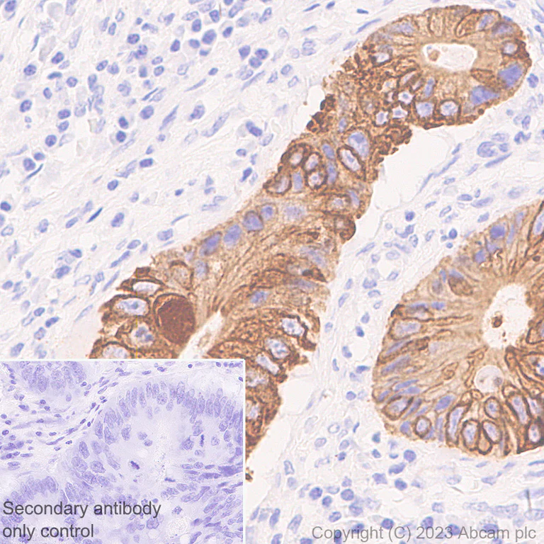 Immunohistochemistry (Formalin/PFA-fixed paraffin-embedded sections) - Anti-pan cytokeratin antibody [EPR28285-45] - BSA and Azide free (AB308263)