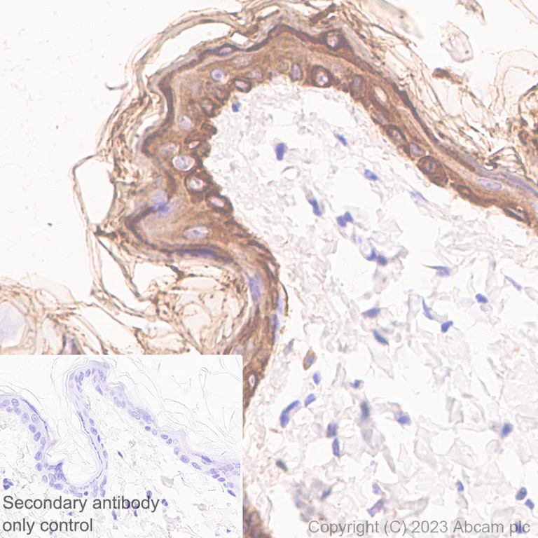 Immunohistochemistry (Formalin/PFA-fixed paraffin-embedded sections) - Anti-pan cytokeratin antibody [EPR28285-45] - BSA and Azide free (AB308263)