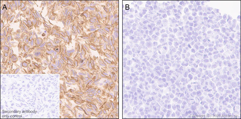 Immunohistochemistry (Formalin/PFA-fixed paraffin-embedded sections) - Anti-pan cytokeratin antibody [EPR28285-45] - BSA and Azide free (AB308263)
