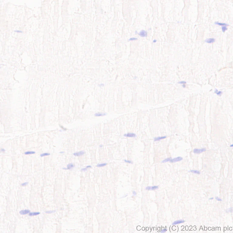 Immunohistochemistry (Formalin/PFA-fixed paraffin-embedded sections) - Anti-pan cytokeratin antibody [EPR28285-45] - BSA and Azide free (AB308263)