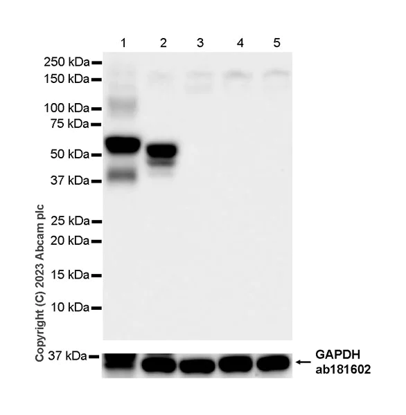 Western blot - Anti-pan cytokeratin antibody [EPR28285-45] - BSA and Azide free (AB308263)