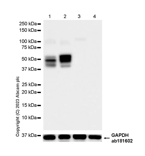 Western blot - Anti-pan cytokeratin antibody [EPR28285-45] - BSA and Azide free (AB308263)