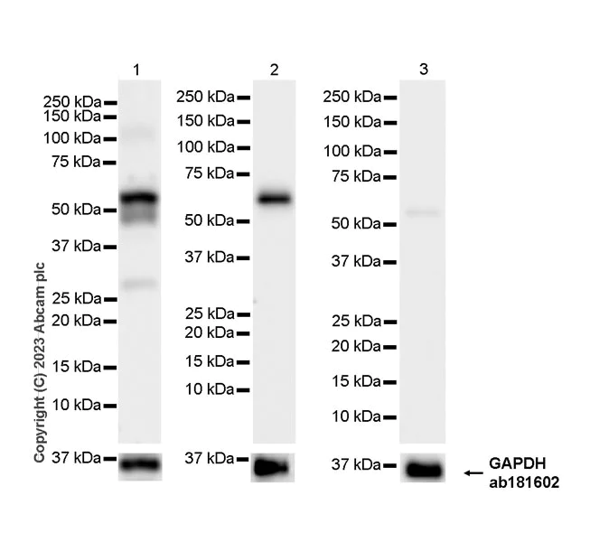 Western blot - Anti-pan cytokeratin antibody [EPR28285-45] - BSA and Azide free (AB308263)