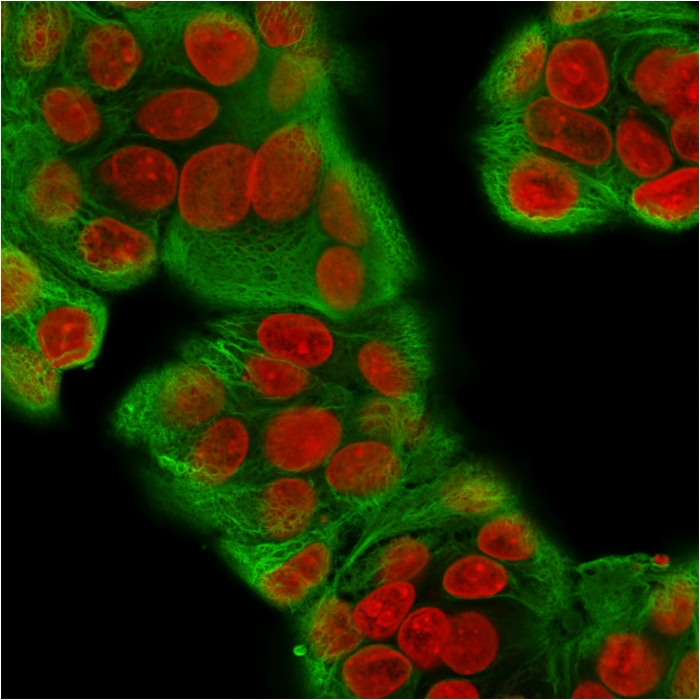Immunocytochemistry - Anti-pan Cytokeratin antibody [KRT/1877R] (AB234297), expandable thumbnail