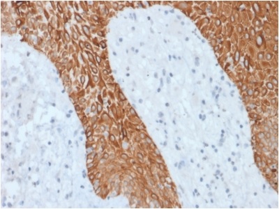 Immunohistochemistry (Formalin/PFA-fixed paraffin-embedded sections) - Anti-pan Cytokeratin antibody [KRT/1877R] (AB234297), expandable thumbnail