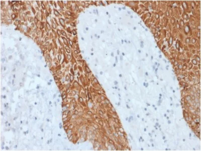 Immunohistochemistry (Formalin/PFA-fixed paraffin-embedded sections) - Anti-pan Cytokeratin antibody [KRT/1877R] - BSA and Azide free (AB236323)