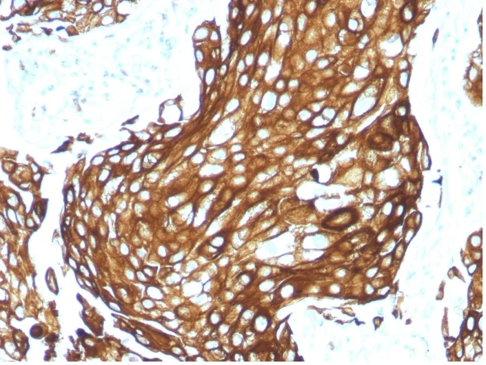 Immunohistochemistry (Formalin/PFA-fixed paraffin-embedded sections) - Anti-pan Cytokeratin antibody [KRTL/1577R] - BSA and Azide free (AB270305)
