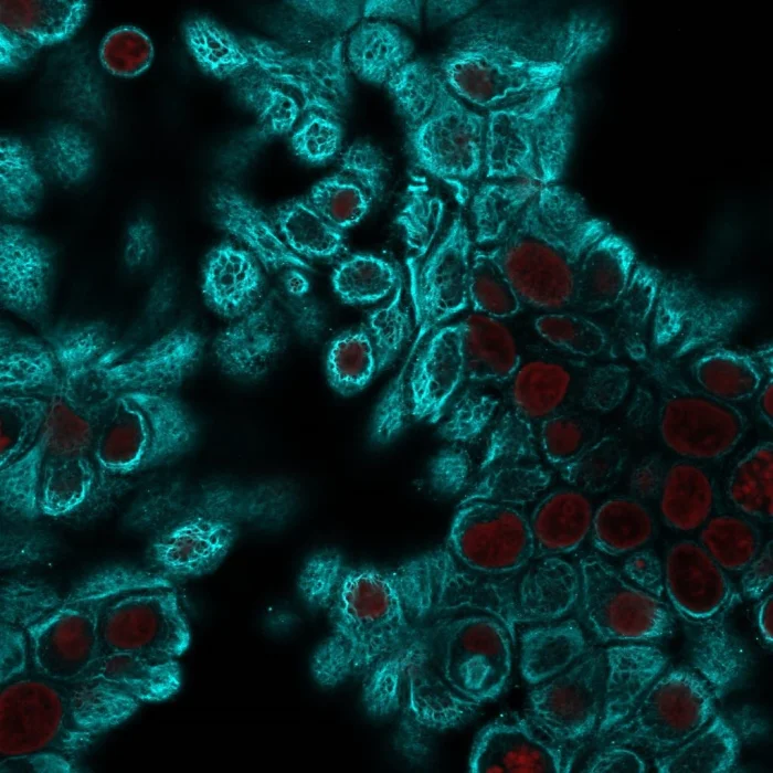 Immunocytochemistry - Anti-pan Cytokeratin antibody [PAN-CK (Cocktail)] (AB215838)