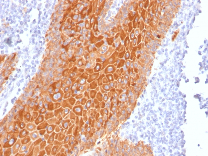 Immunohistochemistry (Formalin/PFA-fixed paraffin-embedded sections) - Anti-pan Cytokeratin antibody [PAN-CK (Cocktail)] (AB215838), expandable thumbnail