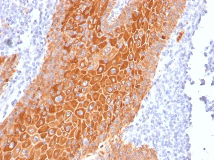 Immunohistochemistry (Formalin/PFA-fixed paraffin-embedded sections) - Anti-pan Cytokeratin antibody [PAN-CK (Cocktail)] (AB215838)