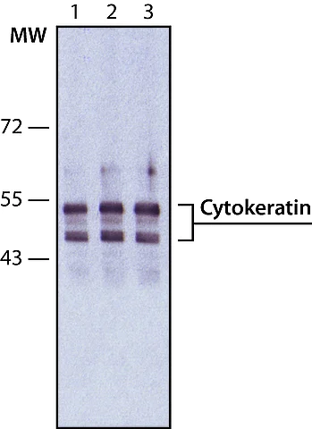 Western blot - Anti-pan Cytokeratin antibody [PCK-26] (AB6401)