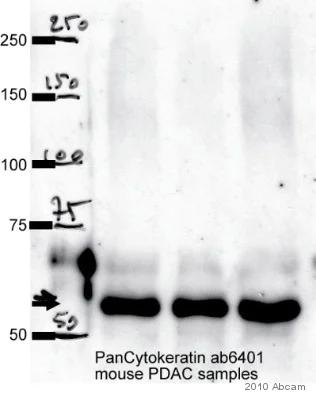 Western blot - Anti-pan Cytokeratin antibody [PCK-26] (AB6401)