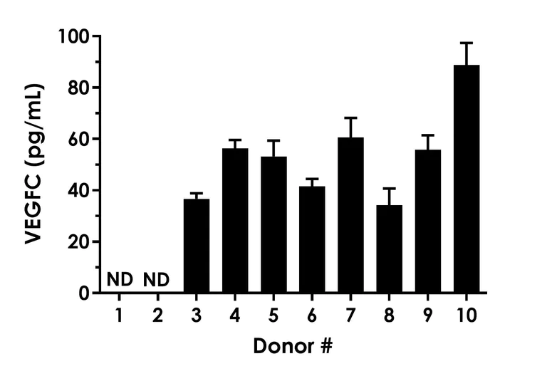 Sandwich ELISA - pan-HMR VEGFC ELISA Kit (AB315050)