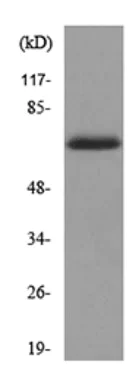 Western blot - Anti-pan Keratin antibody (AB190625)