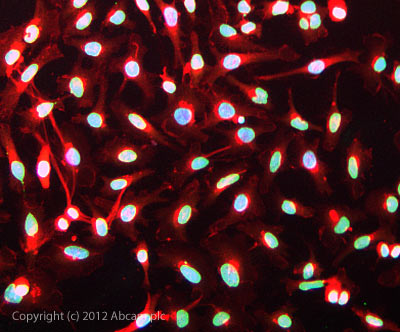 Immunocytochemistry/ Immunofluorescence - Anti-pan methyl Lysine antibody - ChIP Grade (AB7315)