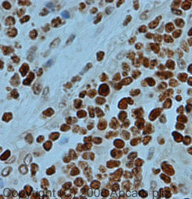Immunohistochemistry (Formalin/PFA-fixed paraffin-embedded sections) - Anti-pan methyl Lysine antibody - ChIP Grade (AB7315)