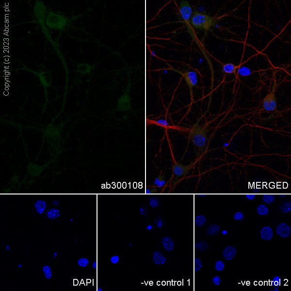 Immunocytochemistry/ Immunofluorescence - Anti-pan PDE4 antibody [EPR25202-101] (AB300108), expandable thumbnail