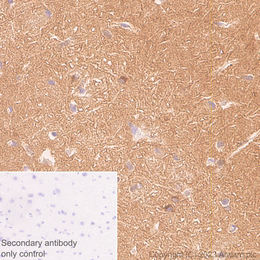 Immunohistochemistry (Formalin/PFA-fixed paraffin-embedded sections) - Anti-pan PDE4 antibody [EPR25202-101] (ab300108), expandable thumbnail
