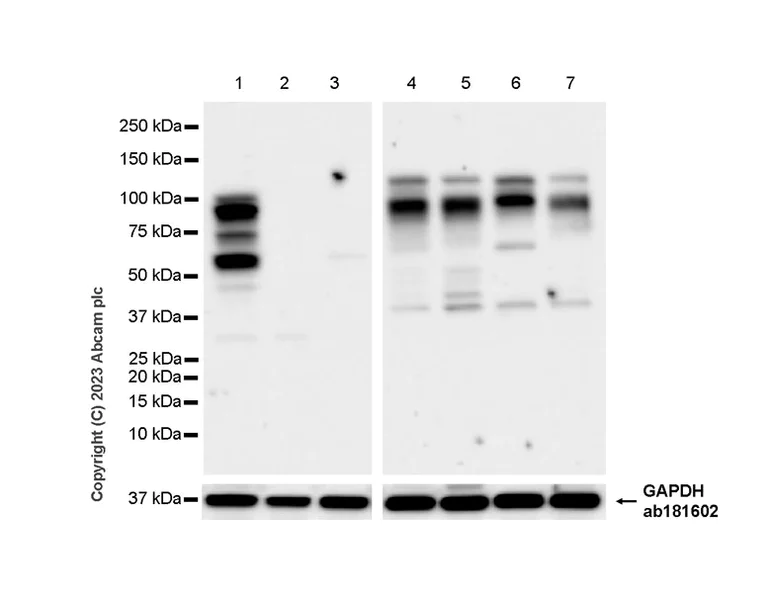Western blot - Anti-pan PDE4 antibody [EPR25202-101] (AB300108)
